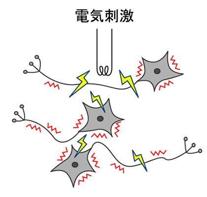 電気刺激の図